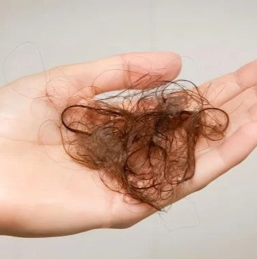 Finasteride Alternatives: Natural and Prescription Options for Hair Loss